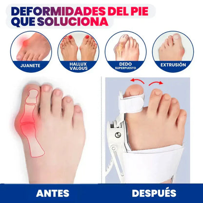 FLEXTOE® RECUPERA TUS PASOS, EVITA LA OPERACIÓN